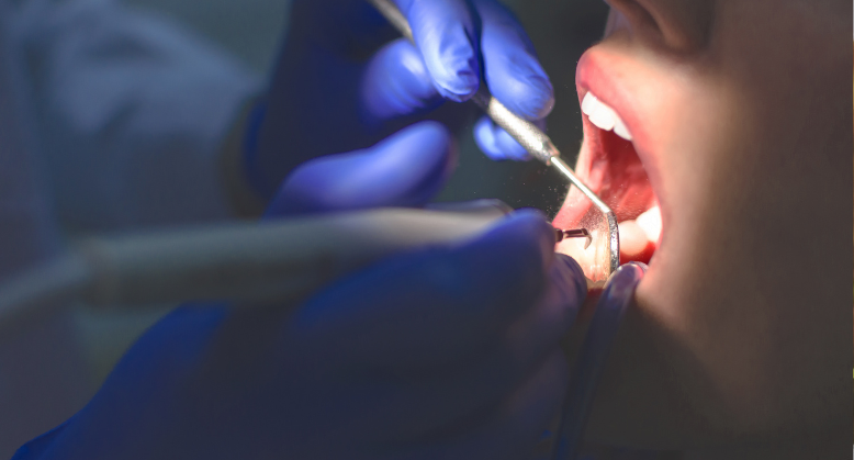 Santa Maria se prepara para implementar programa nacional de reconstrução dentária para vítimas de violência doméstica